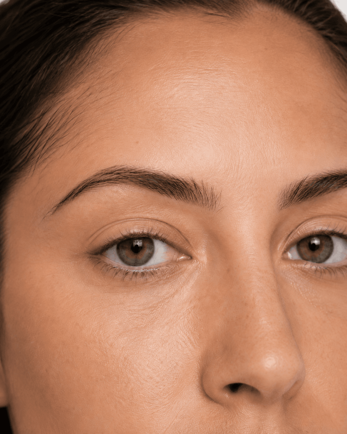 Lash line enhancement — before